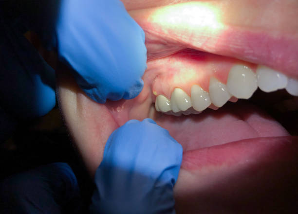 Best Tooth Infection Emergency Dentist  in Shawnee, OK