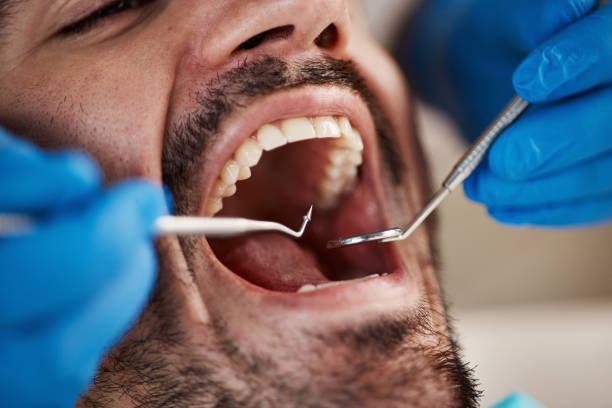Best Emergency Tooth Extraction  in Shawnee, OK