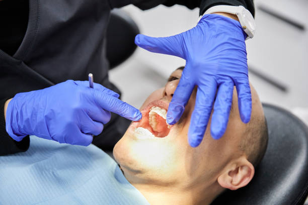 Best Chipped Tooth Repair Near Me  in Shawnee, OK